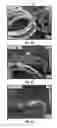 Fig. 06 - System and method of monitoring a utility structure