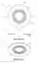 Fig. 18 - Peripheral sealing gland for elongate objects passing through a surface or beyond a pipe end