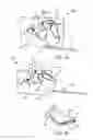 Fig. 06 - Hood latch crash opening prevention