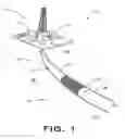 Fig. 02 - Ball drop two stage valve