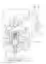 Fig. 17 - Regenerative valve hydraulic actuator