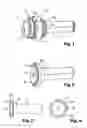Fig. 02 - FILTER CONNECTION TIP OF A SHEATH OR CABLE IN A HOLDER