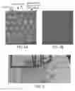 Fig. 04 - MICROFLUIDIC DETERMINATION OF IMMUNE AND OTHER CELLS
