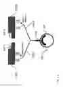 Fig. 03 - Wheel rotational-speed sensor and fastening system for mounting a wheel rotational-speed sensor