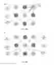 Fig. 09 - Fresnel assembly for light redirection in eye tracking systems
