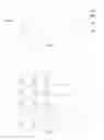 Fig. 04 - Backlight module and liquid crystal display device