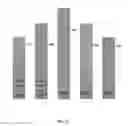 Fig. 10 - Distribution-based analysis of queries for anomaly detection with adaptive thresholding