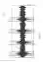 Fig. 08 - SYSTEMS AND METHODS TO DETECT ABNORMALITIES IN A VEHICLE SUSPENSION SYSTEM