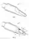 Fig. 02 - Mouthpiece patch for musical instrument