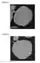Fig. 02 - Positive electrode active material for nonaqueous electrolyte secondary battery and nonaqueous electrolyte secondary battery