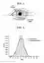 Fig. 04 - Method and means for evaluating toric contact lens rotational stability