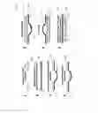 Fig. 17 - Optical device, particularly camera, particularly comprising autofocus, image stabilization and super resolution