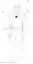 Fig. 01 - Wearable apparatus with wide viewing angle image sensor