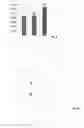 Fig. 06 - Tuft and head for an oral care implement and oral care implement