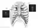 Fig. 01 - Ultrasound system and method for detecting lung sliding