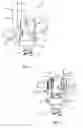 Fig. 02 - Spinal implant system and methods of use