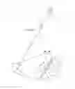 Fig. 05 - SYSTEMS AND METHODS FOR POSTERIOR DYNAMIC STABILIZATION OF THE SPINE