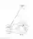 Fig. 06 - SYSTEMS AND METHODS FOR POSTERIOR DYNAMIC STABILIZATION OF THE SPINE
