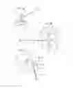 Fig. 07 - SYSTEMS AND METHODS FOR POSTERIOR DYNAMIC STABILIZATION OF THE SPINE