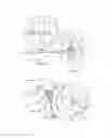 Fig. 09 - SYSTEMS AND METHODS FOR POSTERIOR DYNAMIC STABILIZATION OF THE SPINE