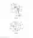 Fig. 11 - SYSTEMS AND METHODS FOR POSTERIOR DYNAMIC STABILIZATION OF THE SPINE