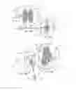 Fig. 14 - SYSTEMS AND METHODS FOR POSTERIOR DYNAMIC STABILIZATION OF THE SPINE