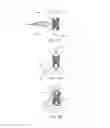 Fig. 17 - SYSTEMS AND METHODS FOR POSTERIOR DYNAMIC STABILIZATION OF THE SPINE