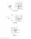 Fig. 19 - SYSTEMS AND METHODS FOR POSTERIOR DYNAMIC STABILIZATION OF THE SPINE