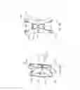 Fig. 36 - SYSTEMS AND METHODS FOR POSTERIOR DYNAMIC STABILIZATION OF THE SPINE
