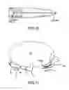 Fig. 07 - Electrosurgical sealer and divider
