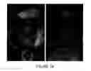 Fig. 49 - Non-thermal ablation system for treating tissue