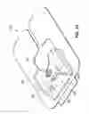 Fig. 72 - Systems and methods for positioning an elongate member inside a body
