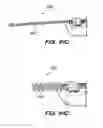Fig. 83 - Systems and methods for positioning an elongate member inside a body