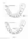 Fig. 09 - Virtual fillers for virtual models of dental arches
