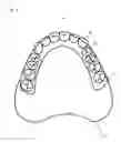 Fig. 07 - Method for designing denture, method for producing denture and positioning means