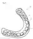 Fig. 09 - Method for designing denture, method for producing denture and positioning means