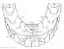 Fig. 01 - Denture-securing device
