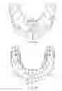 Fig. 04 - Denture-securing device