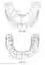 Fig. 08 - Denture-securing device