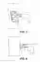 Fig. 04 - Treating eye diseases by deploying a stent