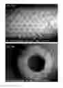 Fig. 06 - Flexible hollow lumen composite