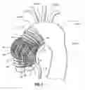 Fig. 02 - SYSTEMS AND METHODS FOR TREATMENT OF AORTIC DISSECTION