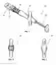 Fig. 02 - Intraocular lens (IOL) injector and method of use thereof