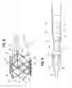 Fig. 06 - Mechanically expandable heart valve