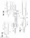 Fig. 07 - Mechanically expandable heart valve