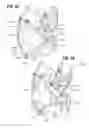 Fig. 22 - Mechanically expandable heart valve