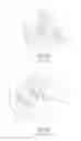 Fig. 02 - FLEXIBLE CONSTRAINED LINER FOR HIP PROSTHESIS