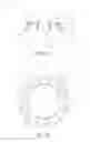 Fig. 03 - FLEXIBLE CONSTRAINED LINER FOR HIP PROSTHESIS