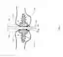 Fig. 06 - System and method for repairing articular surfaces