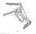Fig. 02 - Artificial epistropheus support body